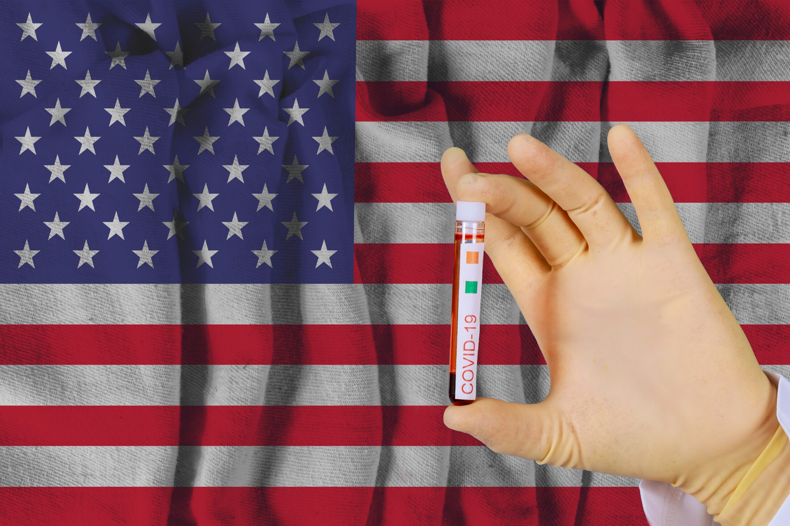 Blood sample with COVID-19 Coronavirus chinese infection of the USA with test in medical exam laboratory