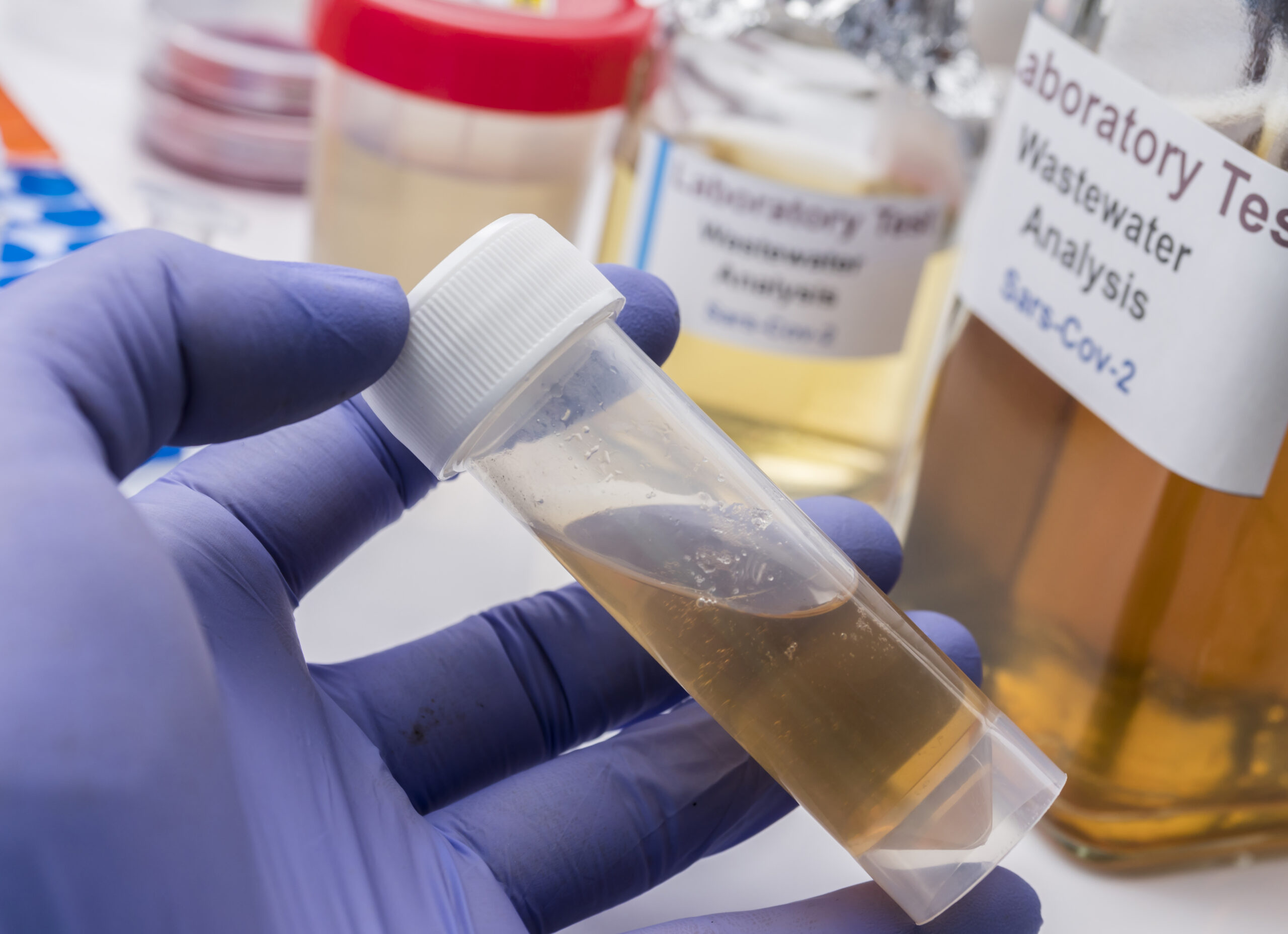 Scientific analysis of wastewater sample in laboratory, investigation of possible contamination by Sars-Cov-2 in humans, conceptual image