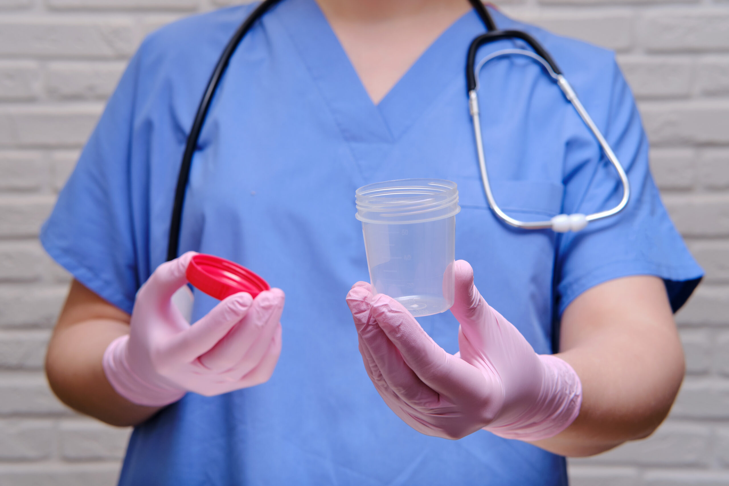 the-doctor-hand-holds-a-container-for-taking-a-uri-2026-01-11-09-15-48-utc